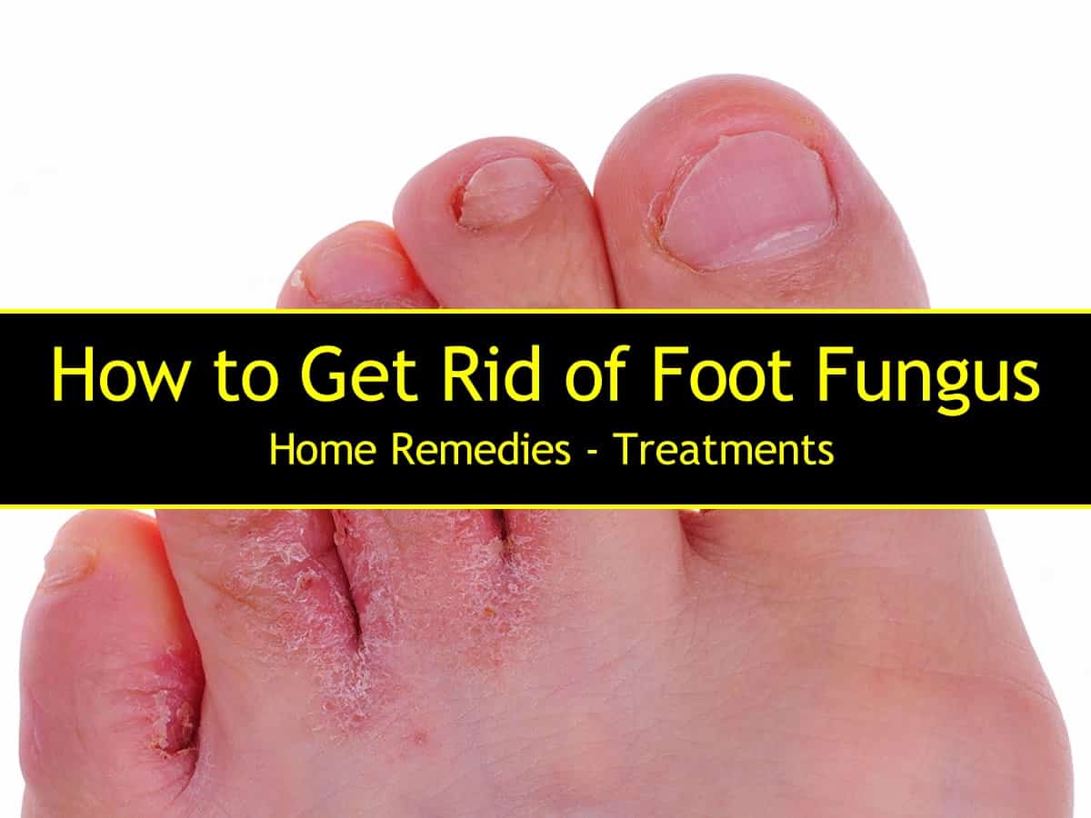 Toenail Fungus Treatments - Weil Foot & Ankle Institute