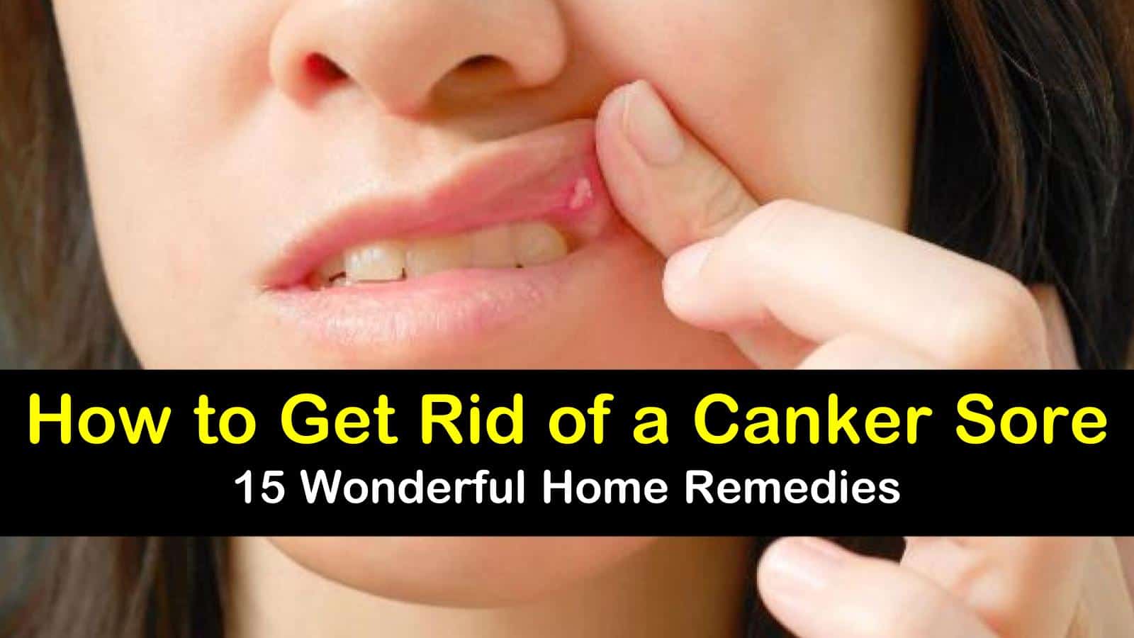 Want to know how to get rid of a canker sore? Check out these 15 home remedies.