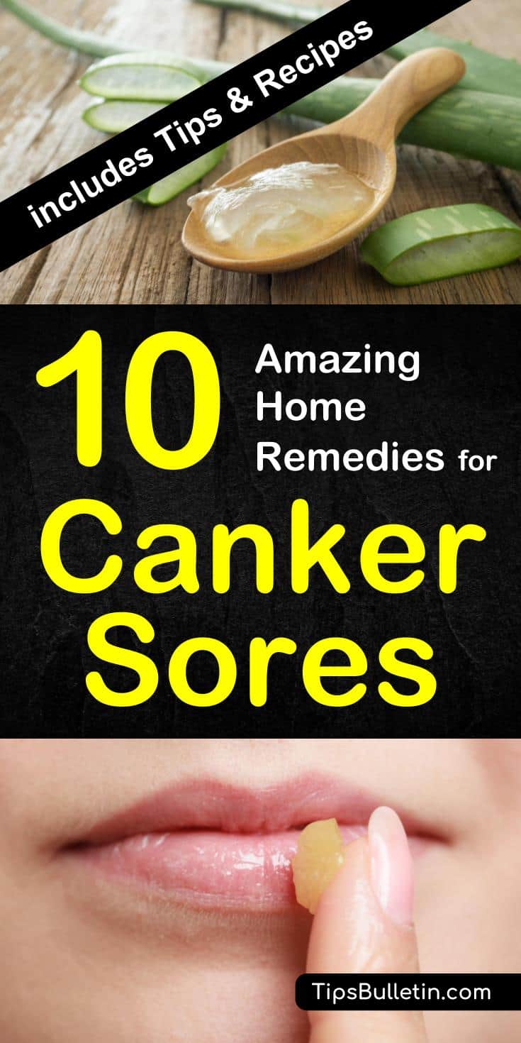 Find out how to get rid of canker sores on tongue with a homemade treatment and DIY remedies. There are a number of common household products that you can use to cure canker sores fast. Ingredients include coconut oil and baking soda. Find quick relief from canker sores in mouth. #cankersorerelief