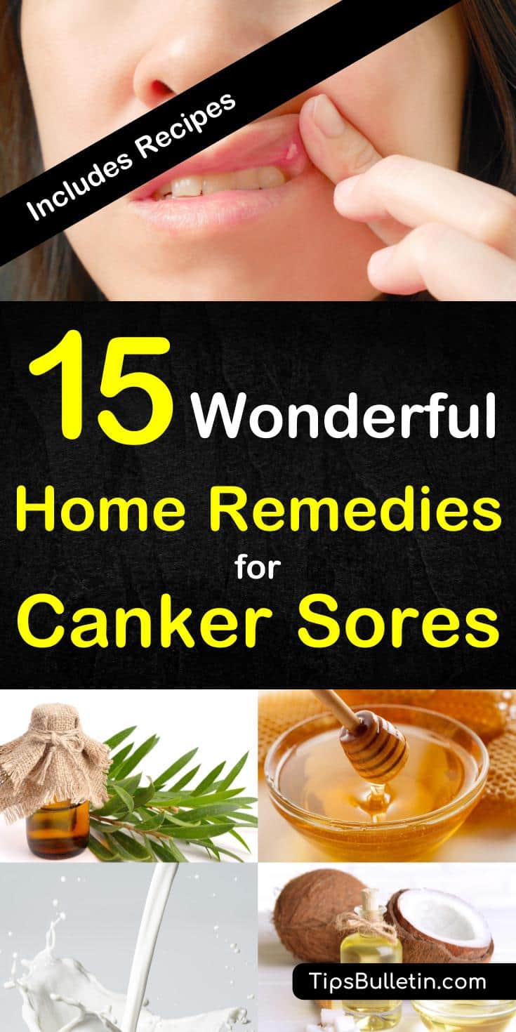 15 wonderful home remedies for canker sores. With detailed information and pictures on what causes and how to get rid of a canker sore on gums, tongue or on the lip. Includes various recipes for all stages of canker sore.#cankersore #naturalremedy #remedies