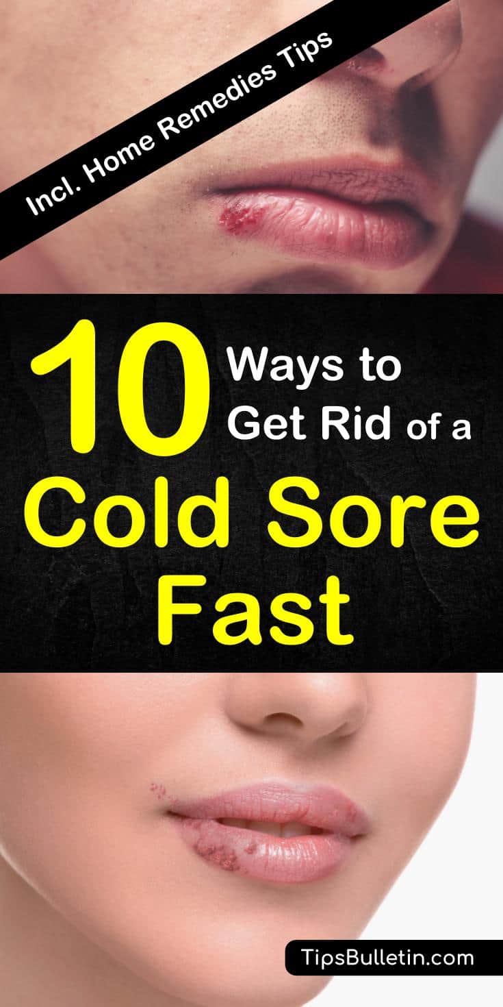 10 Ways To Get Rid Of A Cold Sore Fast