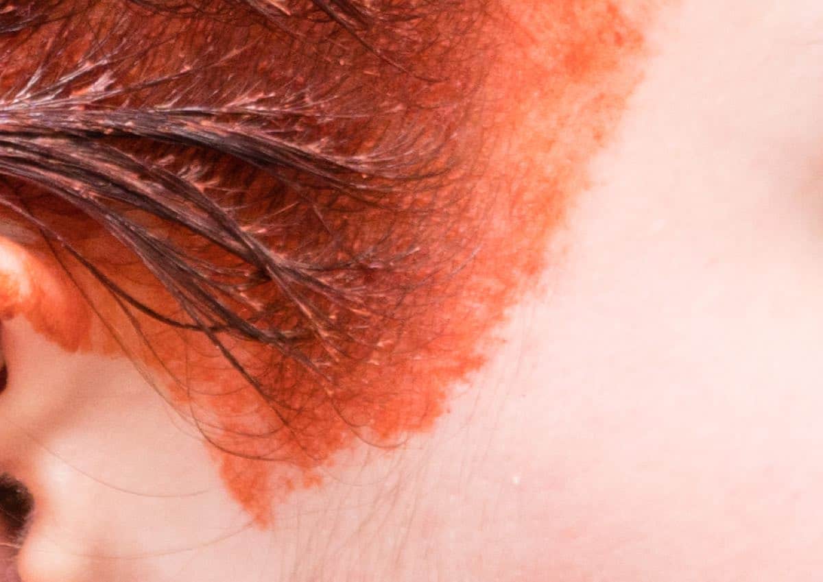 img of hair dye on skin