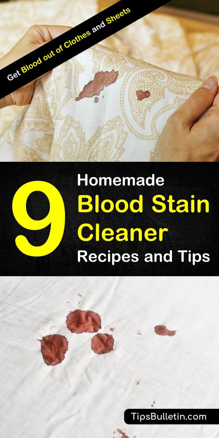 Discover tips for how to get blood out of clothes with these awesome life hacks. Learn how to get blood out of fabric fast with these simple cleaning tips using hydrogen peroxide, baking soda, and other everyday products. Remove blood stains from fabrics fast. #getbloodout #periodstains #bloodstains