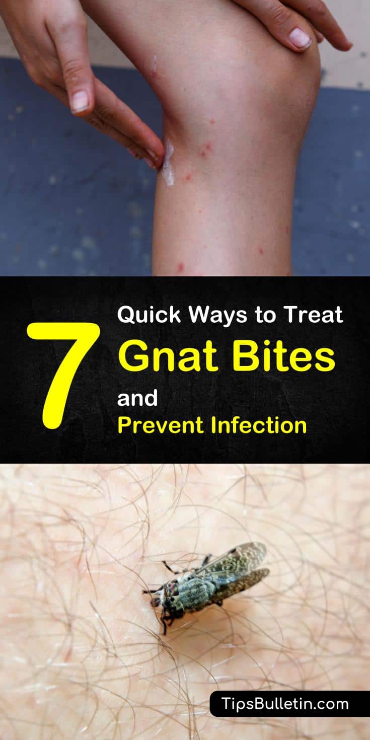 Learn how to treat gnat bites with quick and easy home remedies. Find instant relief from the swelling and itching of gnat bites with essential oils and other natural ingredients. Don't let gnat and other insects get you down. #treatgnatbites #gnatbites #relieffromgnatbites