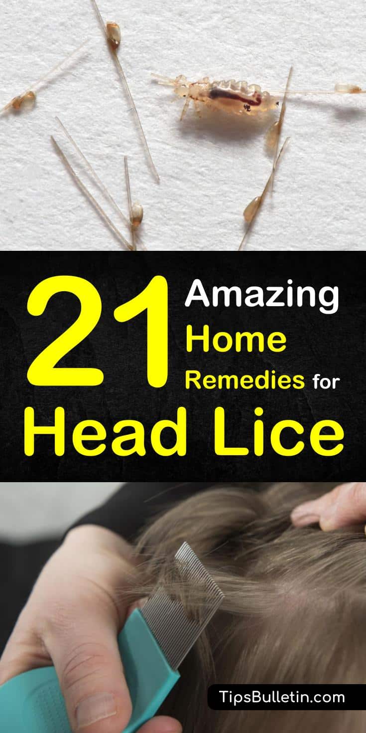 21 Natural Remedies for Head Lice