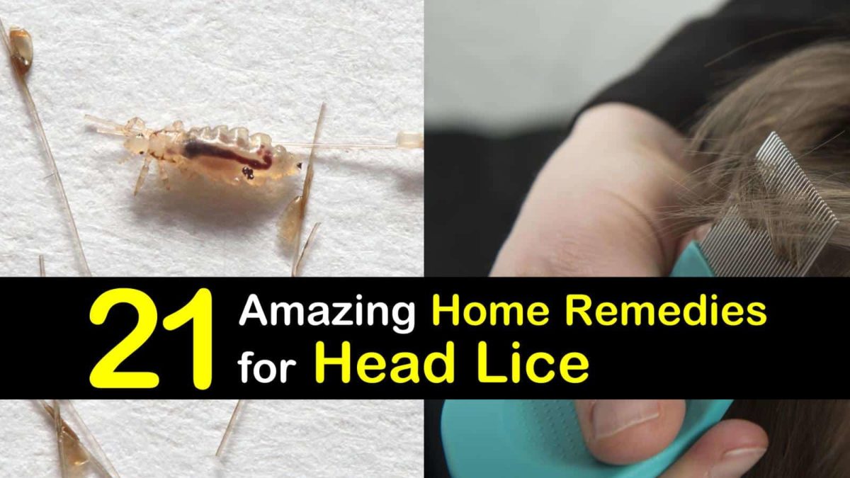 21 Natural Remedies for Head Lice