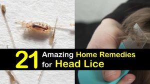 home remedies for head lice titleimg1