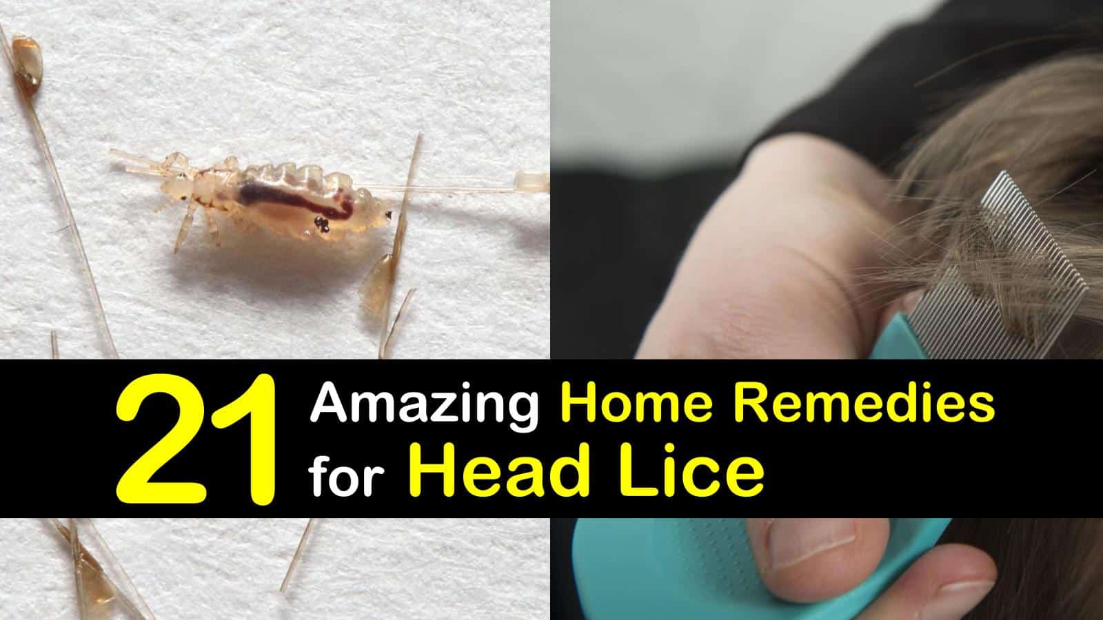 14 Natural Remedies for Head Lice