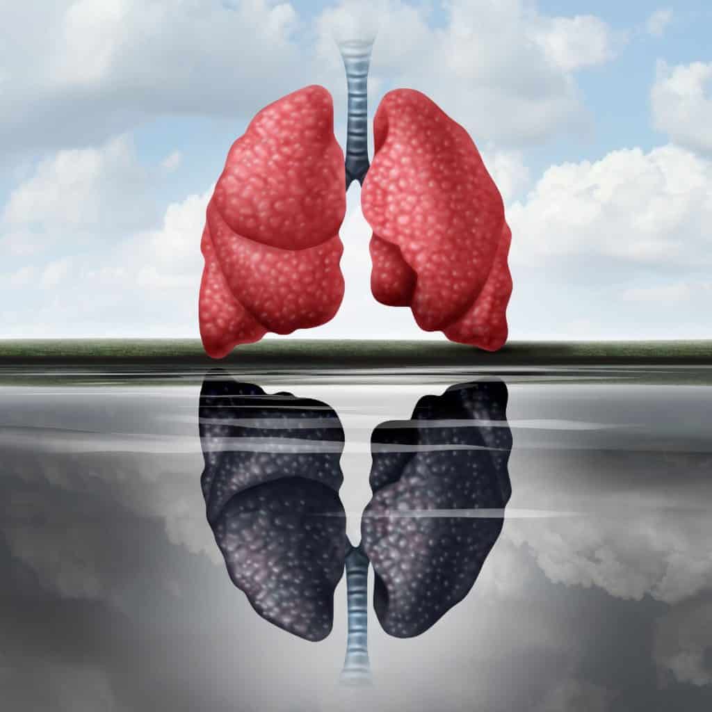 14 EasytoFollow Solutions to Stop Smoking for Good