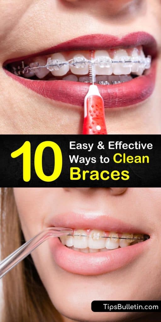 Discover amazing ways to strengthen your oral health in between orthodontist visits and get rid of food particles in braces. The use of fluoride toothpaste, mouthwash, and interdental bristles are some tools you can add to your orthodontic routine. #clean #howto #braces