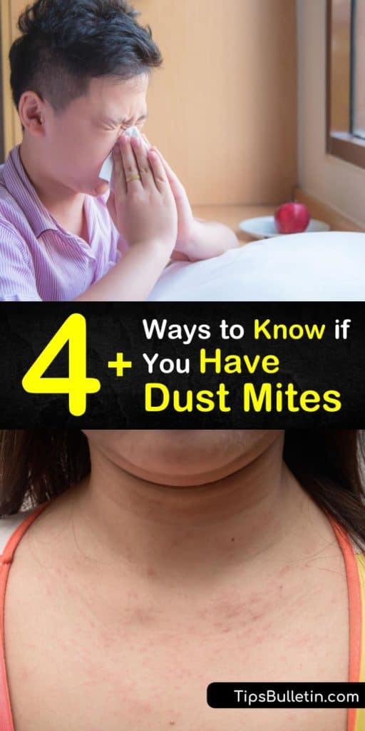 Learn more about a dust mite allergy and how it can cause uncomfortable allergy conditions. From itchy, watery eyes to a runny nose, dust mites that are invisible to the naked eye can make you miserable. Learn the signs of house mites. #dust #mites #allergies