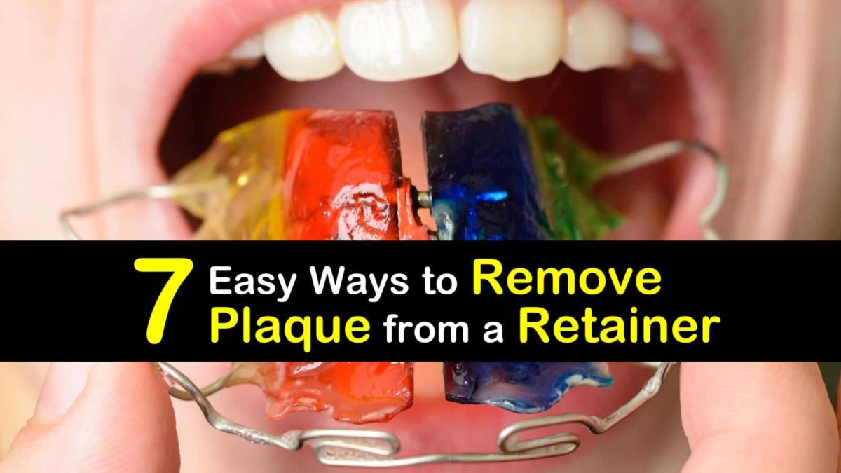 how to remove plaque from a retainer t2 1200x675 cropped