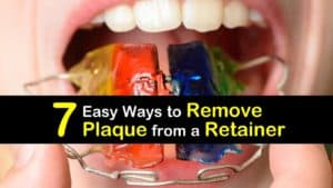 How to Remove Plaque from a Retainer titleimg1
